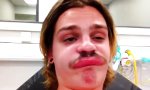 Lustiges Video : Dicke Lippe